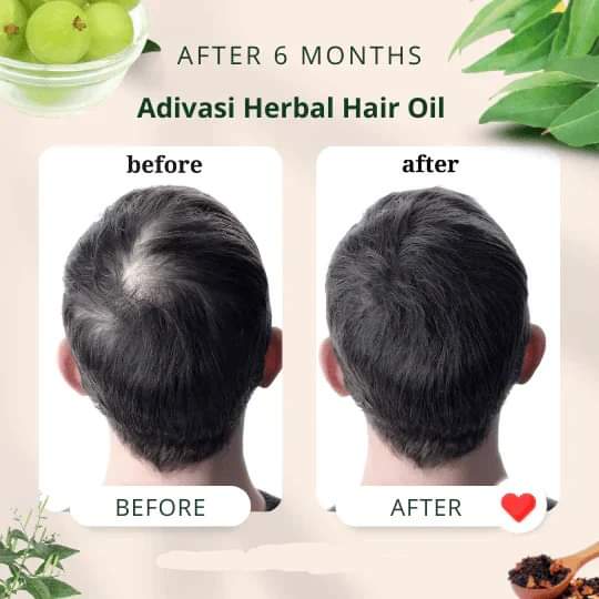 Adivasi herbal hair oil 250ml